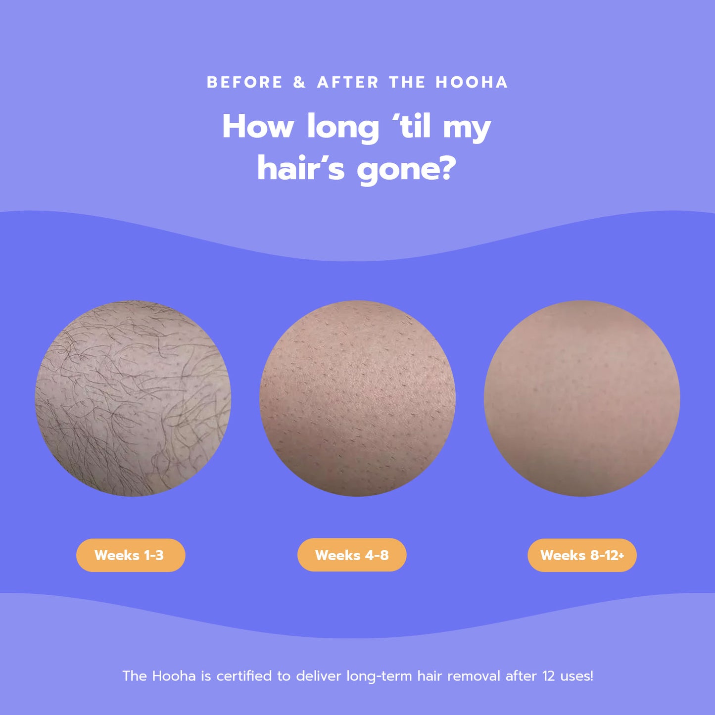 Hooha IPL Replacement Cartridge — 500,000 additional flashes for The Hooha at-home hair removal device