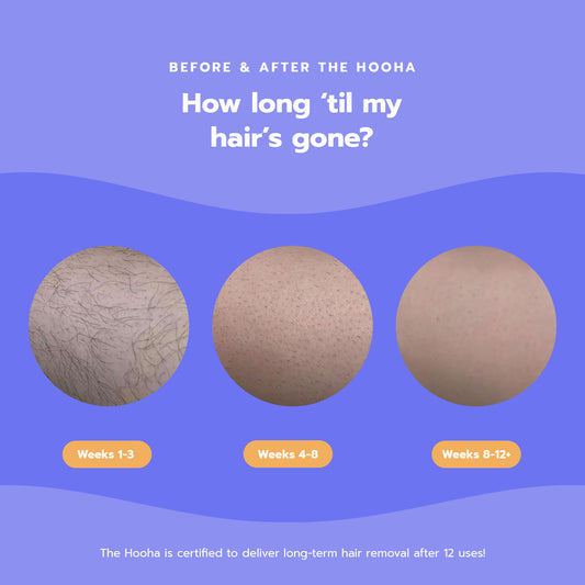 Hooha IPL Replacement Cartridge — 500,000 additional flashes for The Hooha at-home hair removal device